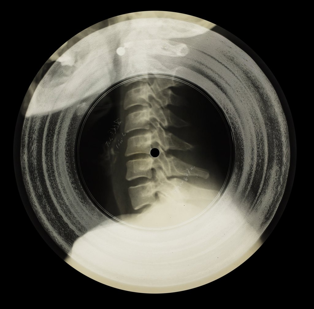 Rëbra: musica su radiografie / Rëbra: bone&nbsp;music